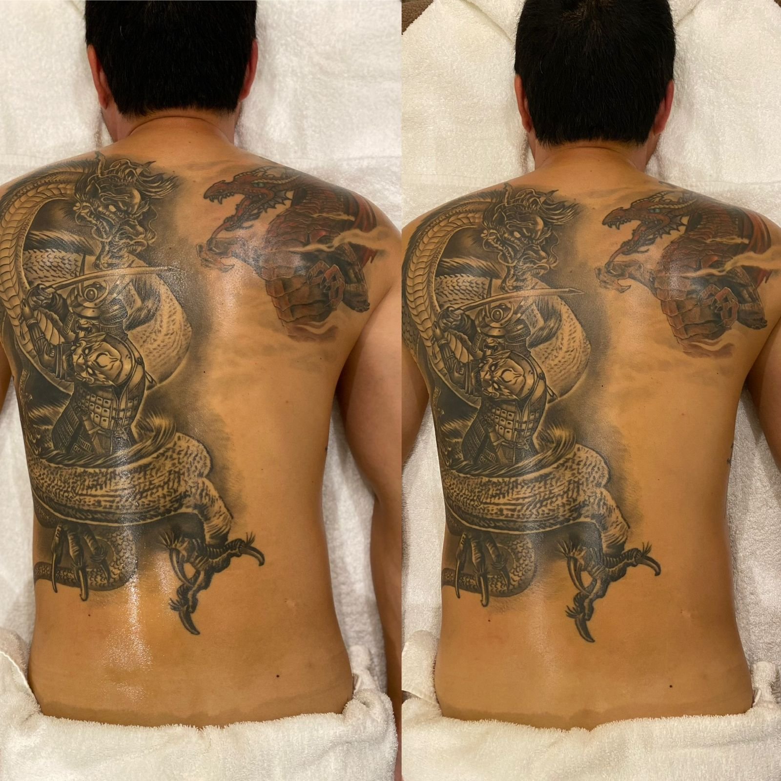 Resultado antes e depois